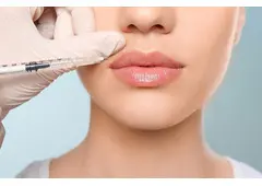 Best Treatment For Dermal Fillers in Muswell Hill