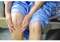 Best Clinic For Knee Replacement Surgery in Novena