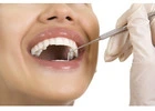 Best Clinic For Root Canal Treatment in Holland V